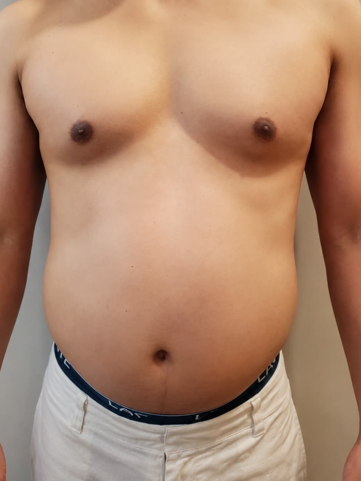 Founder Tiger transformation, Day 1